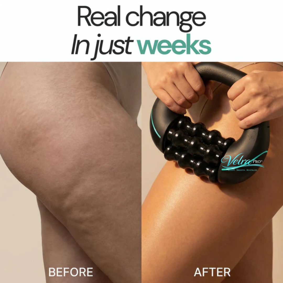 VELRA PRO™ 360° Rotating Body Sculpting Roller
