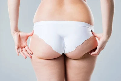 Glutes & under-glute fold
