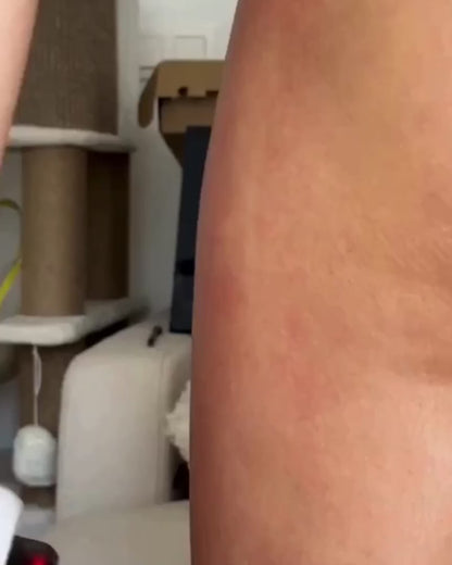 LymphFlow™